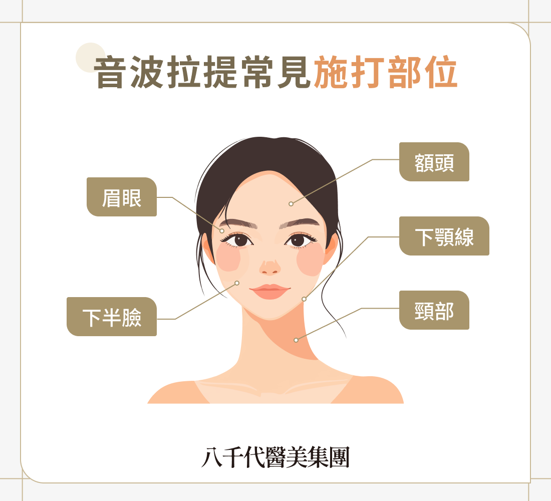 音波拉提常見施打部位