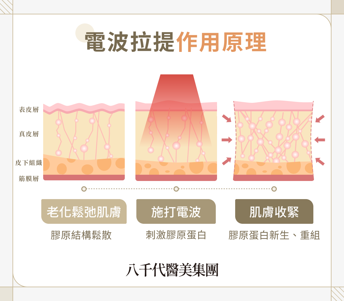 電波拉提作用原理