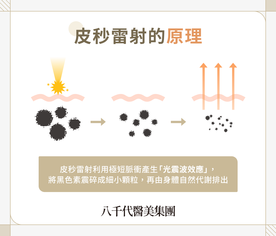 皮秒雷射的原理