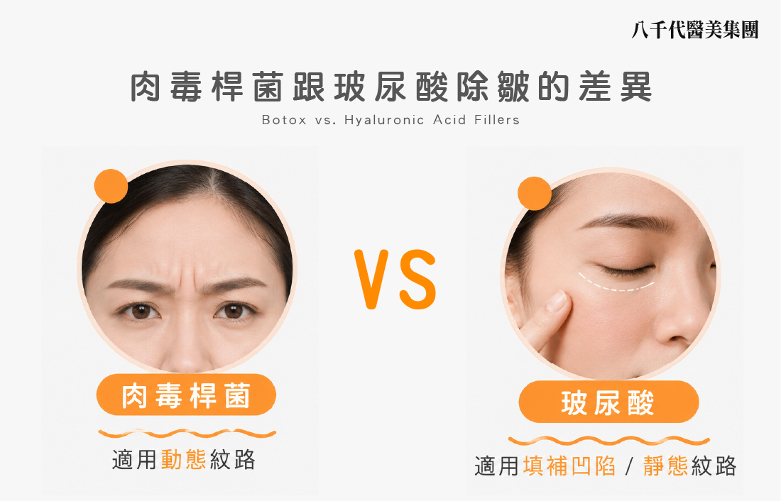 肉毒桿菌與玻尿酸除皺的差異