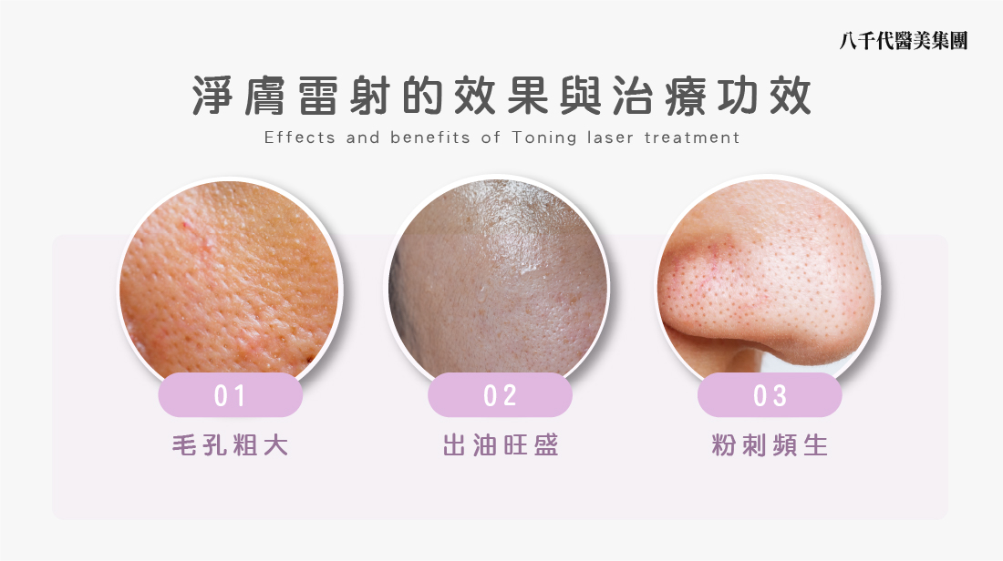 淨膚雷射的治療效果與功效