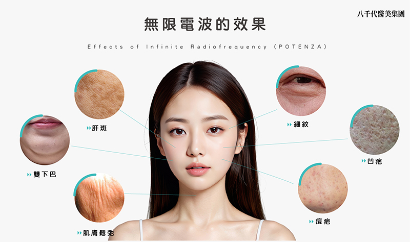 無限電波的效果