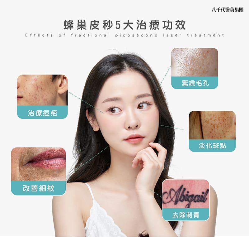 蜂巢皮秒效果示意圖