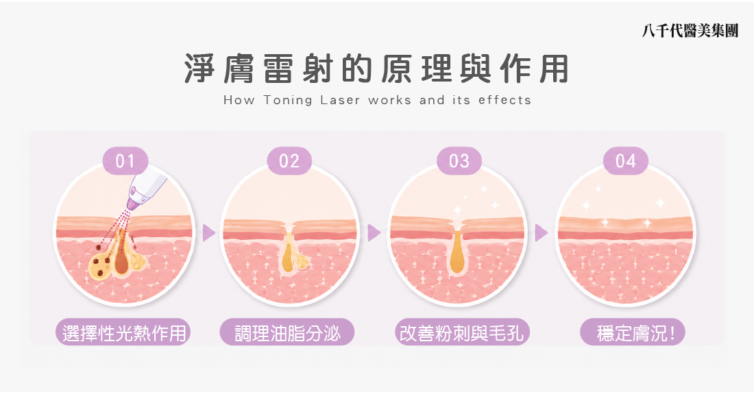 淨膚雷射的原理與作用