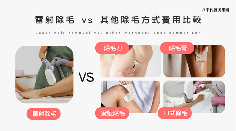 雷射除毛與其他除毛方式費用比較