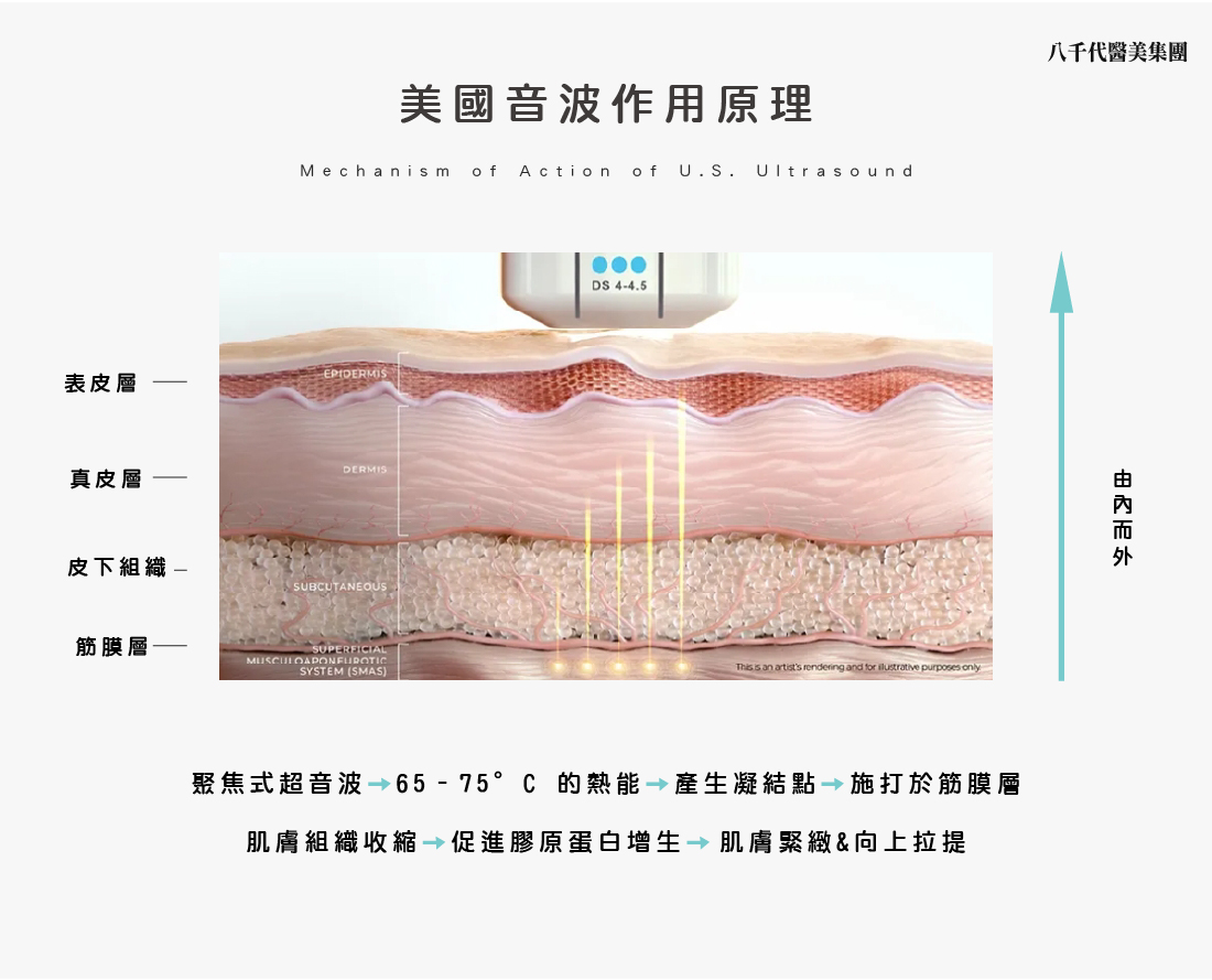 美國音波的作用原理