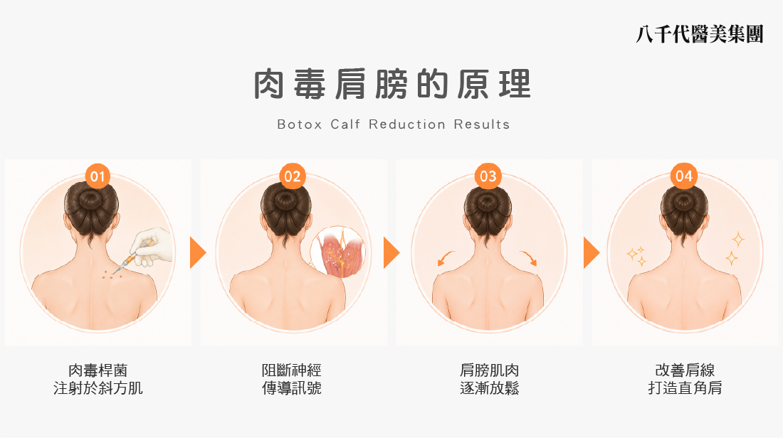 肉毒肩膀作用原理說明