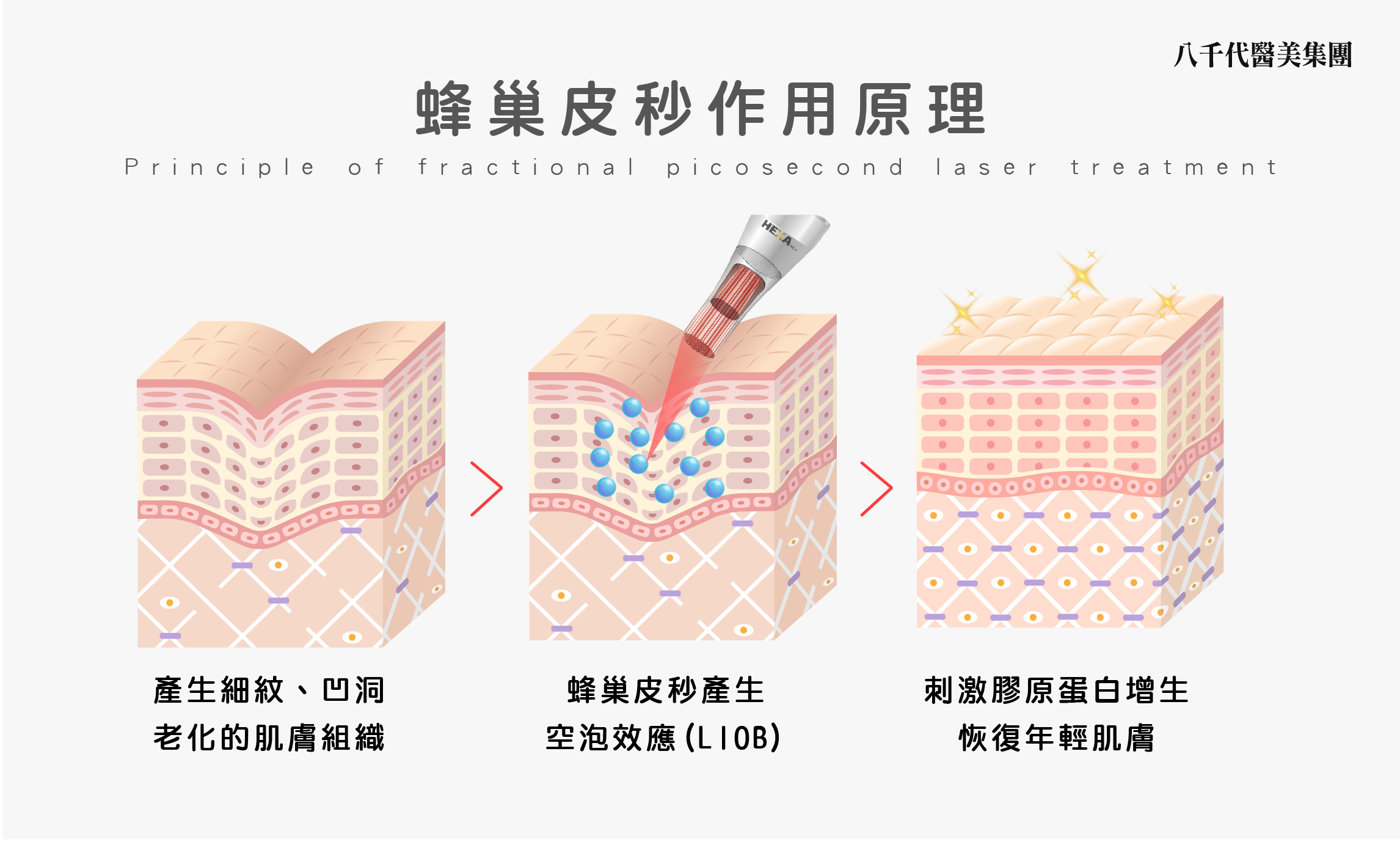 蜂巢皮秒作用原理