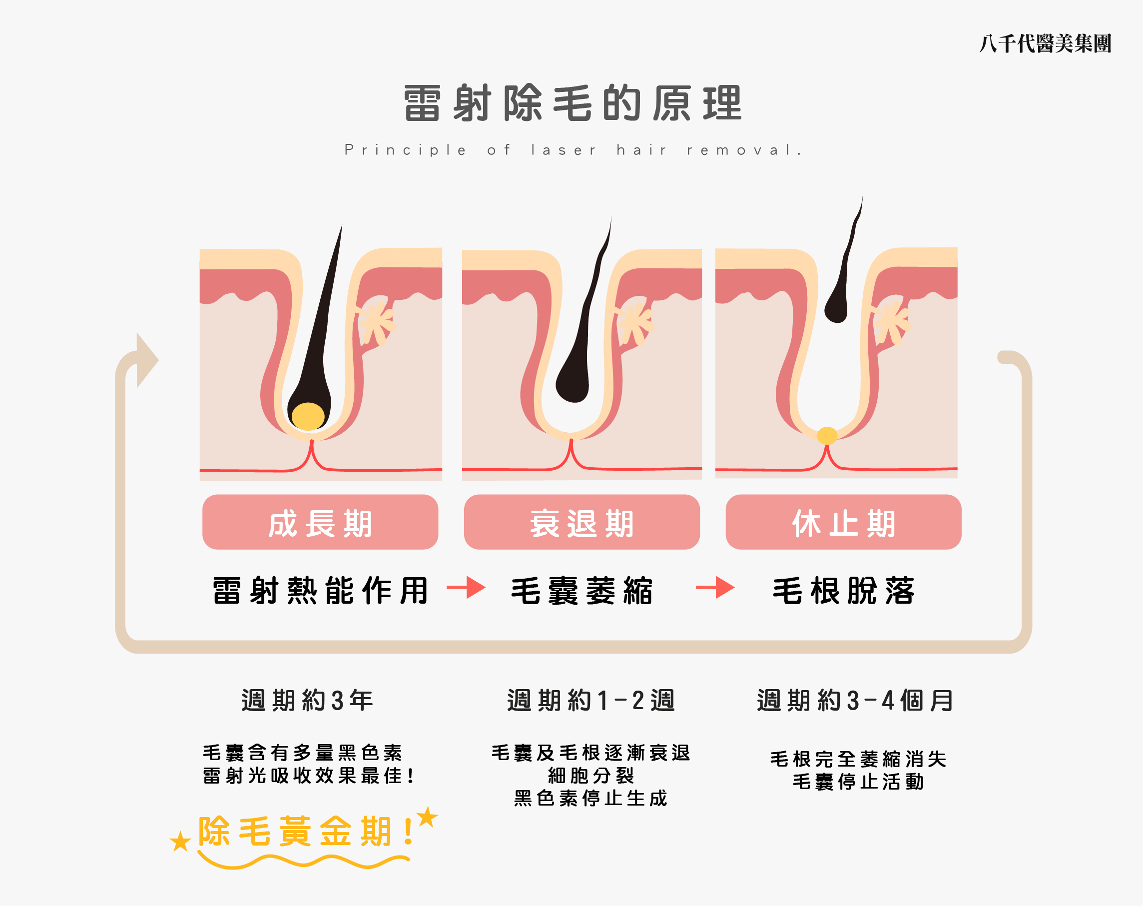 雷射除毛的原理
