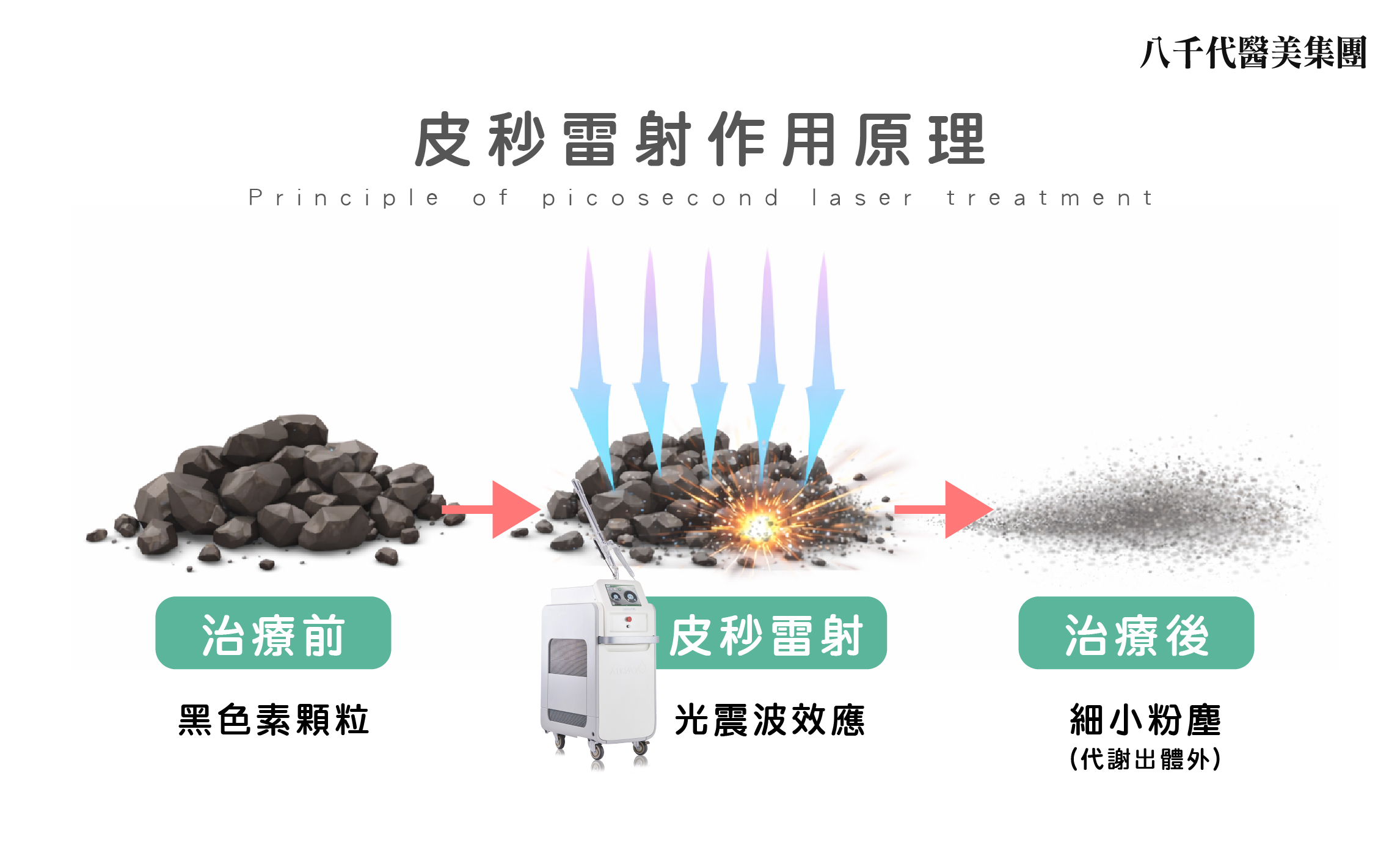 皮秒雷射作用原理