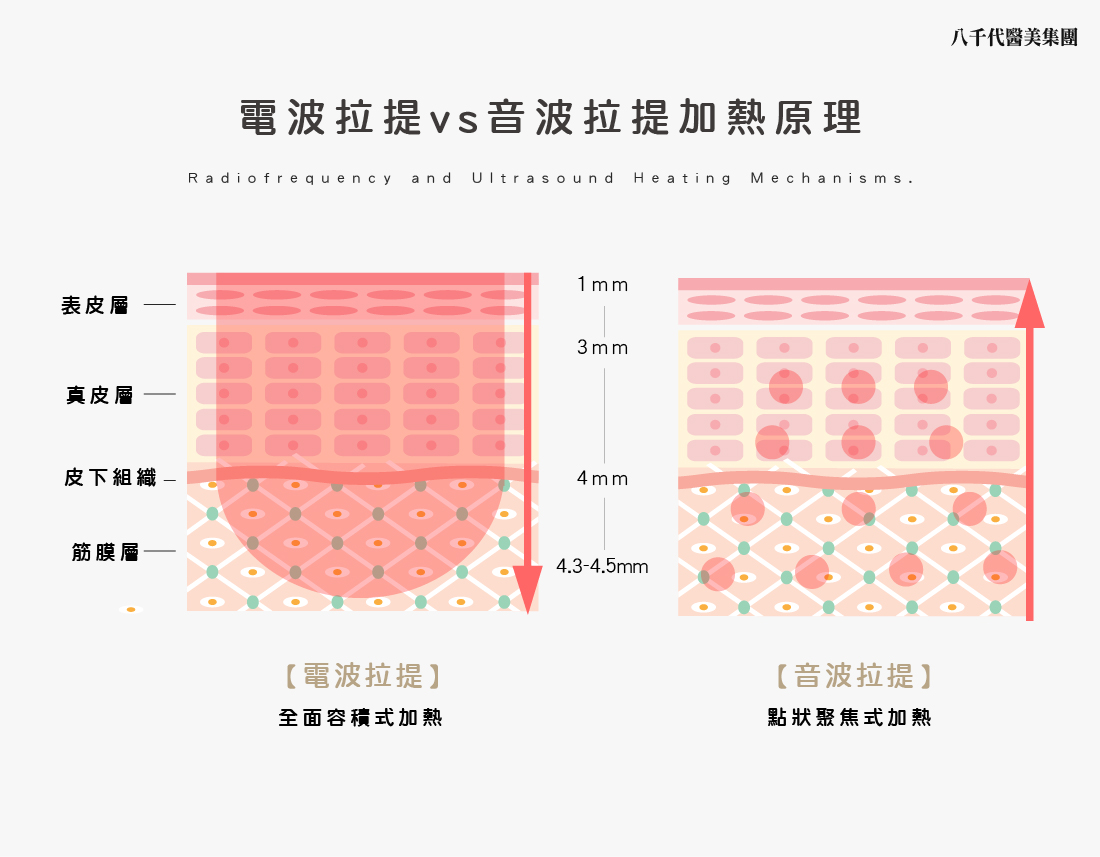 電波拉提音波拉提加熱原理