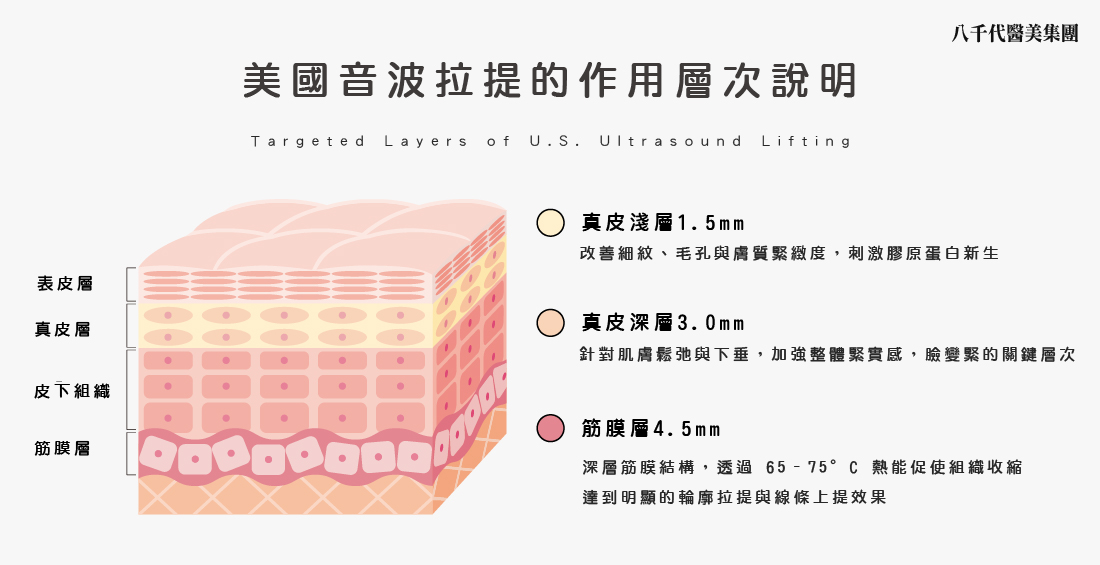 美國音波的作用層次說明