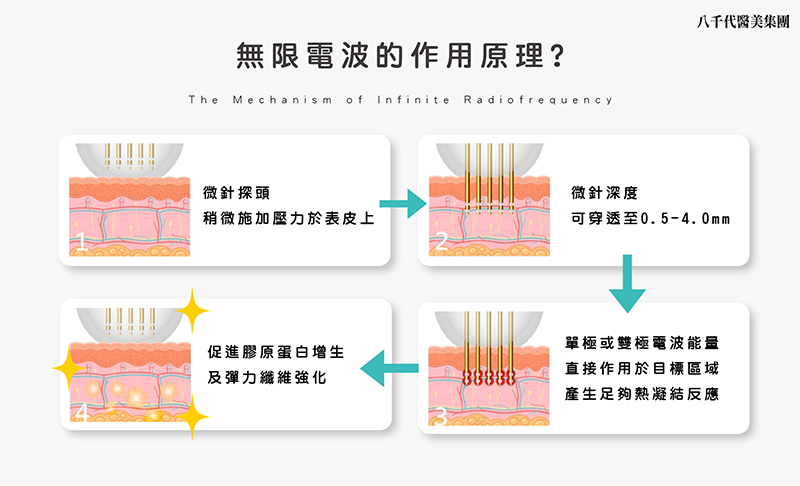 無限電波的作用原理