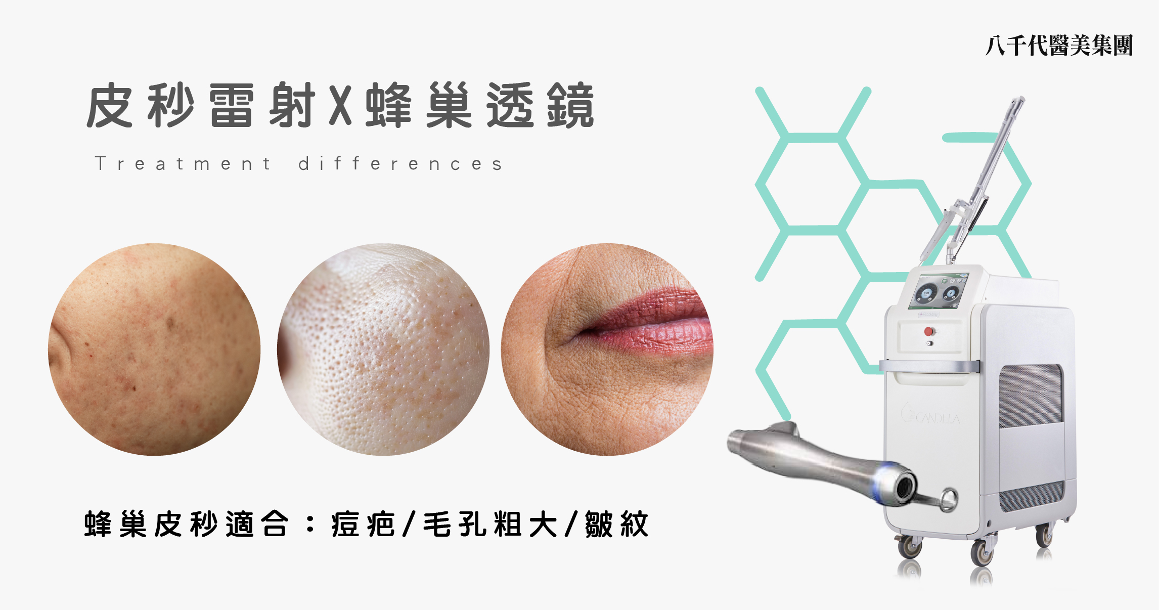 皮秒蜂巢適合痘疤/毛孔粗大/皺紋