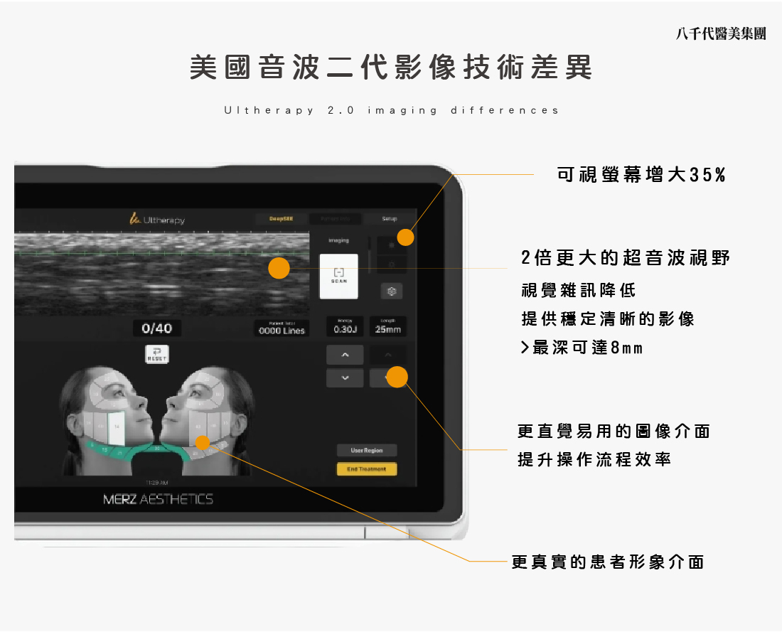 美國音波第二代影像升級差異