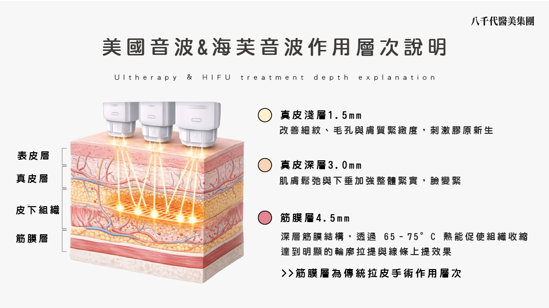 美國音波&海芙音波作用層次