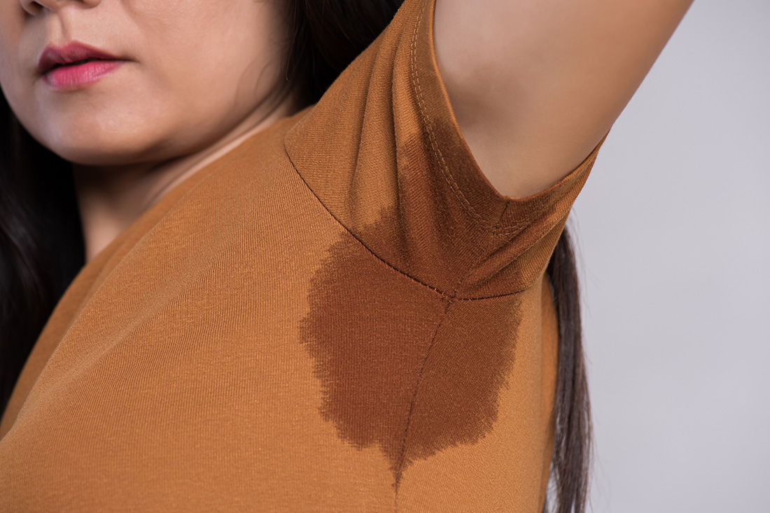 女性舉手腋下大量流汗圖