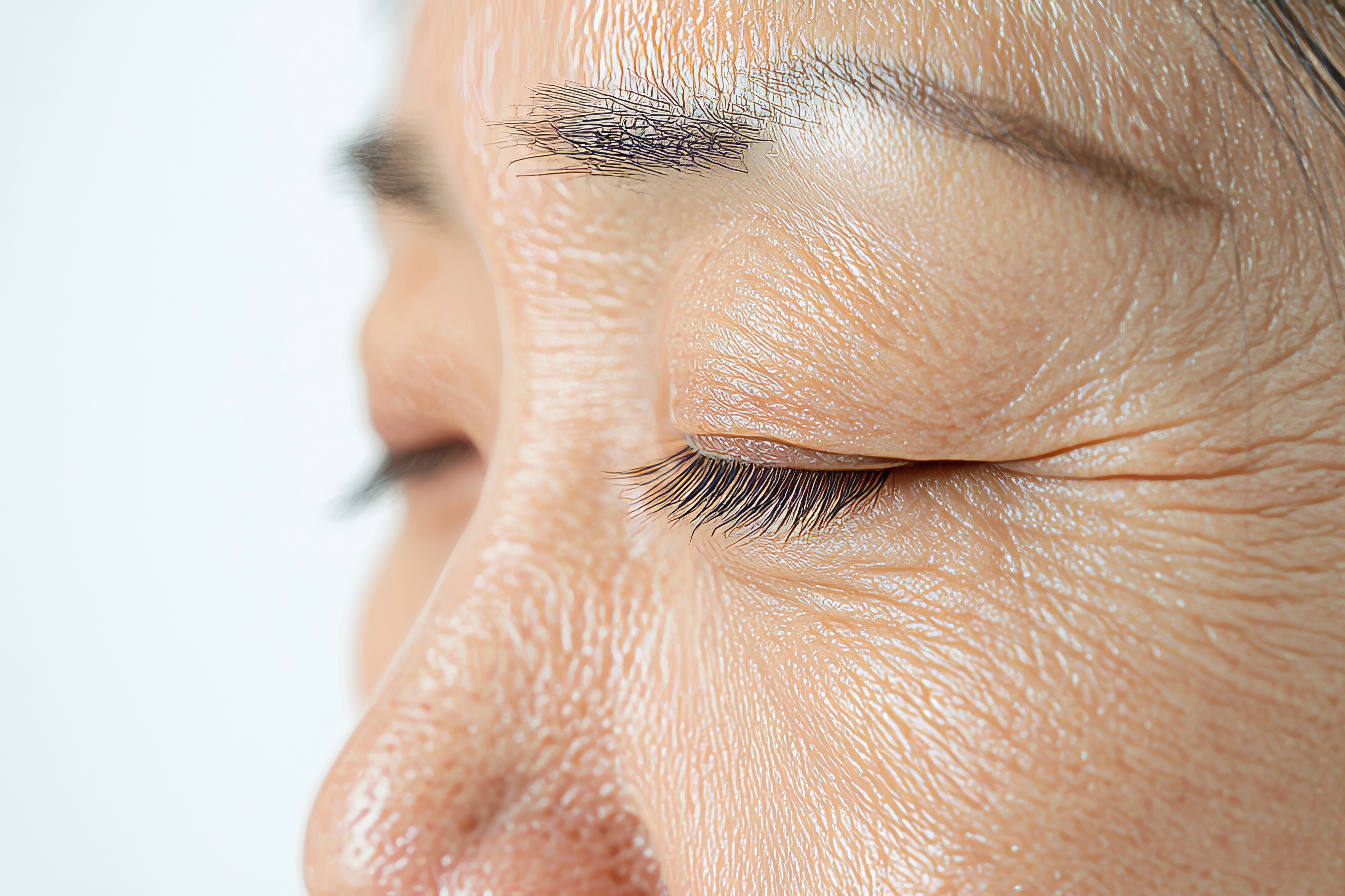 眼部皺紋示意圖