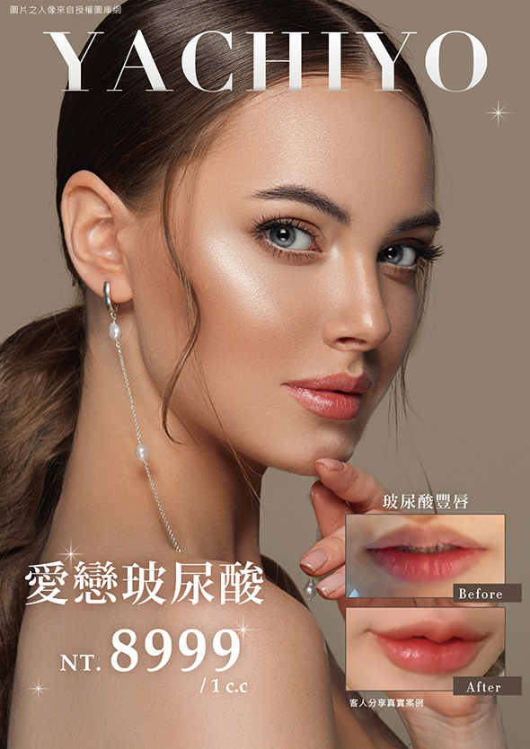 八千代醫美集團愛戀玻尿酸豐唇療程宣傳海報，主打高純度玻尿酸注射，價格 NT.8999 元／1c.c.，可有效改善唇部輪廓、提升豐盈感與立體度，打造自然飽滿的水潤雙唇。圖片展示豐唇 Before/After 真實案例，適合追求性感唇形、改善唇線不明顯或唇部乾扁問題者。