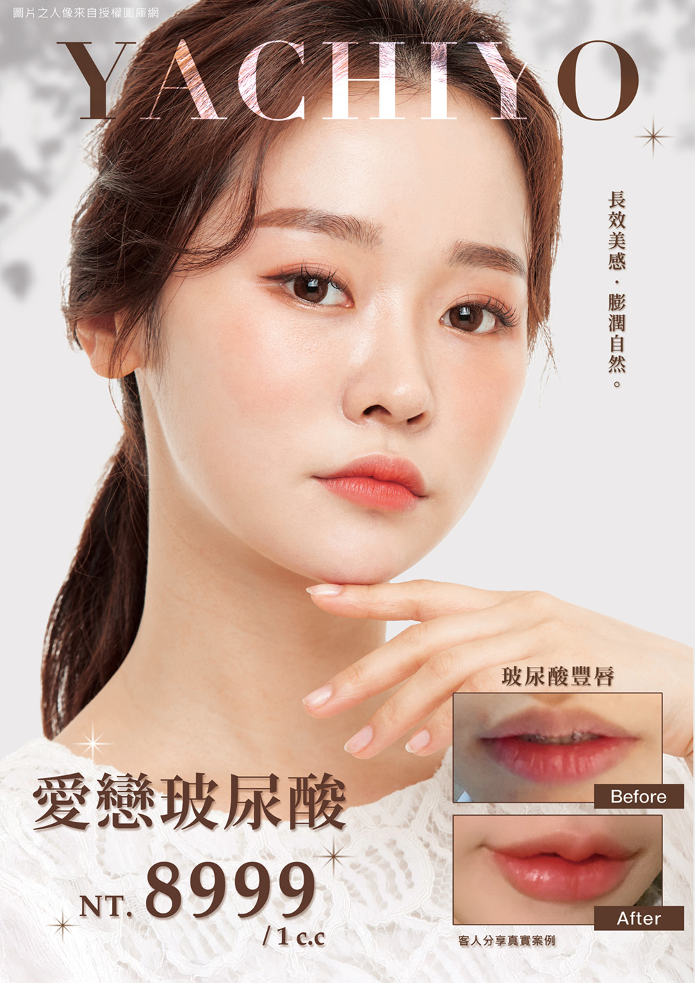 八千代醫美集團愛戀玻尿酸豐唇療程宣傳海報，主打高純度玻尿酸注射，價格 NT.8999 元／1c.c.，可有效改善唇部輪廓、提升豐盈感與立體度，打造自然飽滿的水潤雙唇。圖片展示豐唇 Before/After 真實案例，適合追求性感唇形、改善唇線不明顯或唇部乾扁問題者。