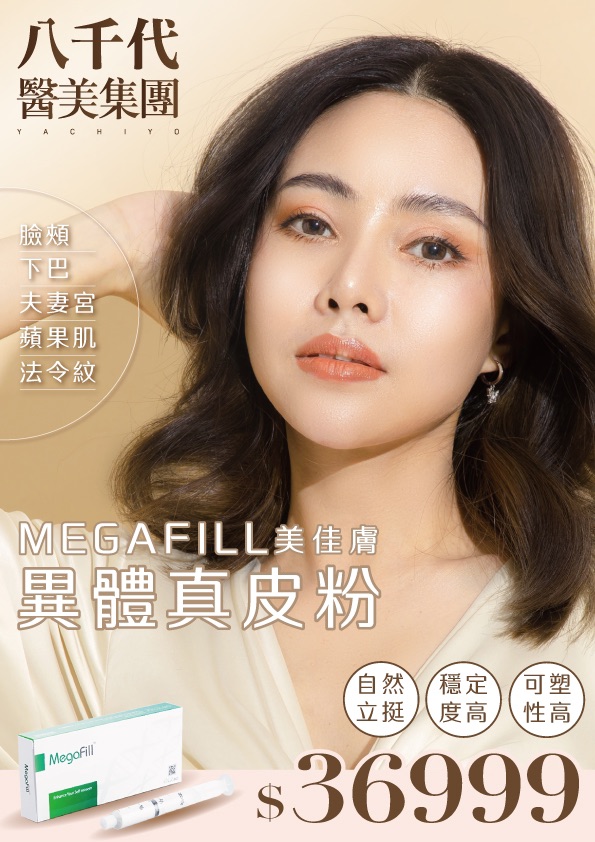八千代醫美集團 MEGAFILL 美佳膚異體真皮粉療程宣傳海報，主打臉頰、下巴、夫妻宮、蘋果肌、法令紋等部位的自然立挺與輪廓雕塑效果。療程價格 $36,999 元，特色包含自然立挺、穩定度高、可塑性強，有效改善凹陷與老化問題，讓臉部線條更立體年輕，重現飽滿肌膚質感。